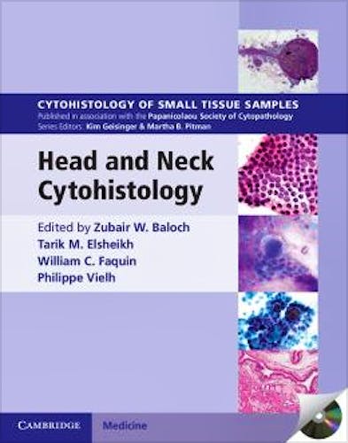 Portada del libro 9781107669888 Head and Neck Cytohistology