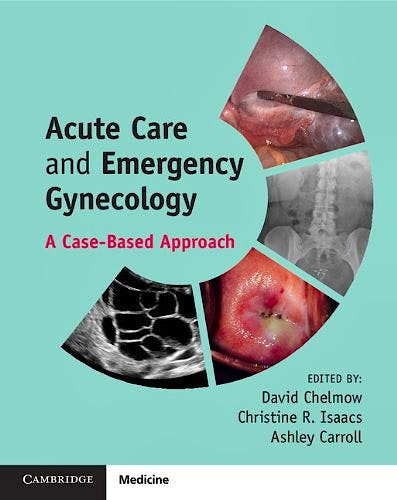 Portada del libro 9781107675414 Acute Care and Emergency Gynecology. a Case-Based Approach
