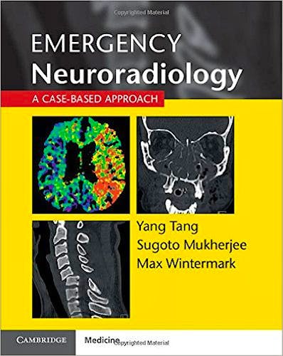 Portada del libro 9781107676138 Emergency Neuroradiology. a Case-Based Approach