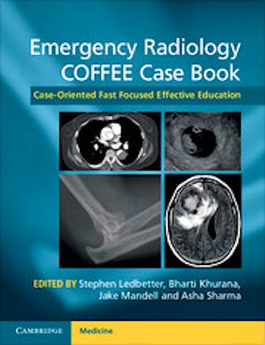 Portada del libro 9781107690769 Emergency Radiology Coffee Case Book. Case-Oriented Fast Focused Effective Education