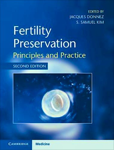 Portada del libro 9781108494595 Fertility Preservation. Principles and Practice