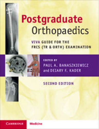 Postgraduate Orthopaedics. Viva Guide for the FRCS (Tr & Orth) Examination