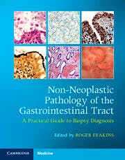 Portada del libro 9781108766548 Non-Neoplastic Pathology of the Gastrointestinal Tract. A Practical Guide to Biopsy Diagnosis
with Online Resource