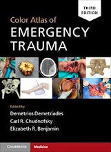 Color Atlas of Emergency Trauma