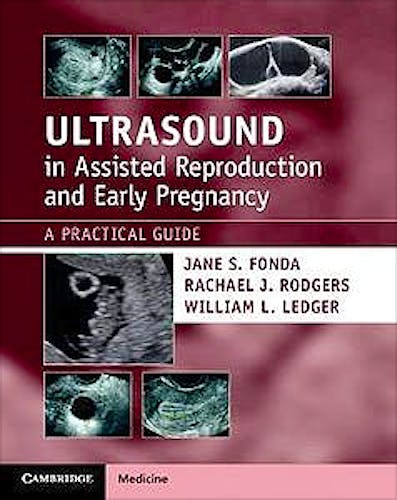 Portada del libro 9781108810210 Ultrasound in Assisted Reproduction and Early Pregnancy. A Practical Guide