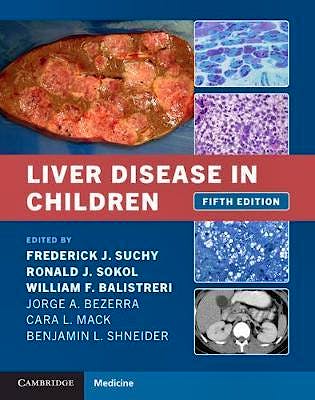 Portada del libro 9781108843515 Liver Disease in Children