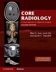 Portada del libro 9781108965910 Core Radiology. A Visual Approach to Diagnostic Imaging, 2 Vols.