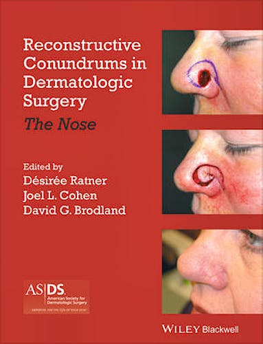 Portada del libro 9781118272329 Reconstructive Conundrums in Dermatologic Surgery. the Nose