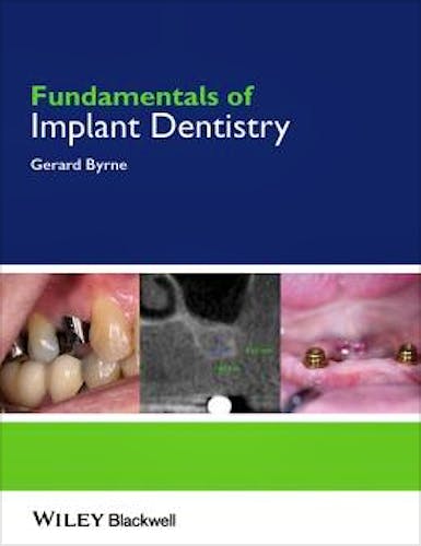 Portada del libro 9781118274965 Fundamentals of Implant Dentistry