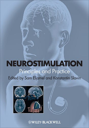 Portada del libro 9781118346358 Neurostimulation. Principles and Practice