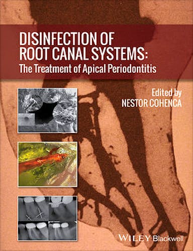 Portada del libro 9781118367681 Disinfection of Root Canal Systems: The Treatment of Apical Periodontitis