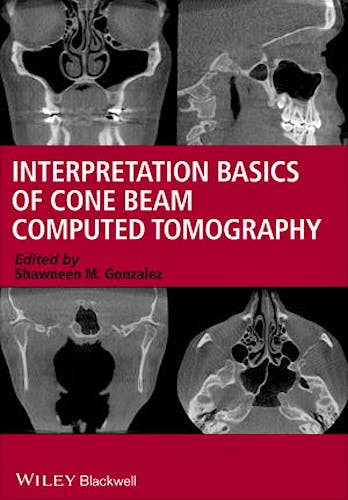 Portada del libro 9781118381069 Interpretation Basics of Cone Beam Computed Tomography