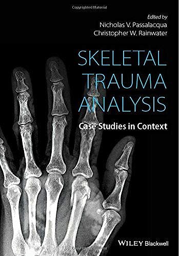 Portada del libro 9781118384220 Skeletal Trauma Analysis. Case Studies in Context
