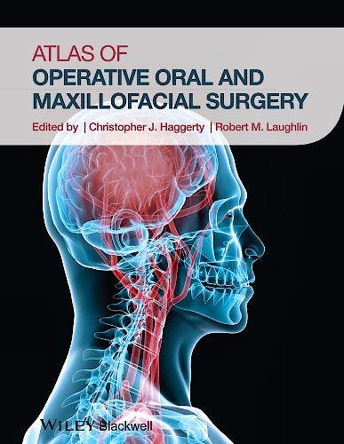 Portada del libro 9781118442340 Atlas of Operative Oral and Maxillofacial Surgery