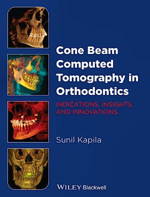 Portada del libro 9781118448489 Cone Beam Computed Tomography in Orthodontics. Indications, Insights, and Innovations + Dvd-Rom