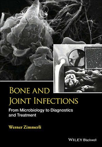 Portada del libro 9781118581773 Bone and Joint Infections. From Microbiology to Diagnostics and Treatment
