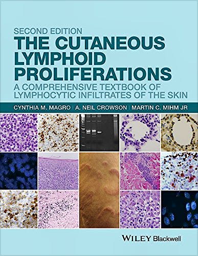 Portada del libro 9781118776261 The Cutaneous Lymphoid Proliferations. A Comprehensive Textbook of Lymphocytic Infiltrates of the Skin