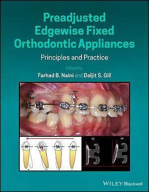 Portada del libro 9781118817698 Preadjusted Edgewise Fixed Orthodontic Appliances. Principles and Practice