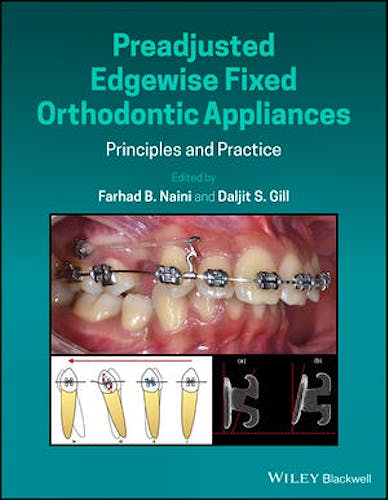 Portada del libro 9781118817698 Preadjusted Edgewise Fixed Orthodontic Appliances. Principles and Practice