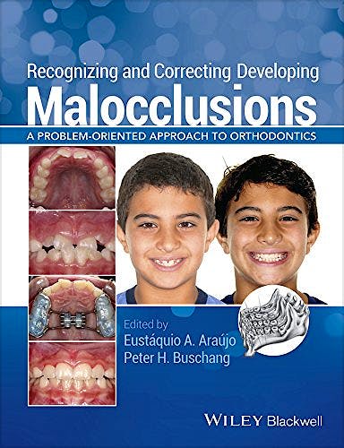 Portada del libro 9781118886120 Recognizing and Correcting Developing Malocclusions: A Problem-Oriented Approaches to Orthodontics