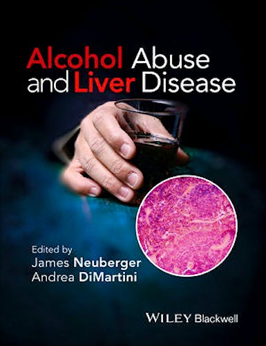 Portada del libro 9781118887288 Alcohol Abuse and Liver Disease