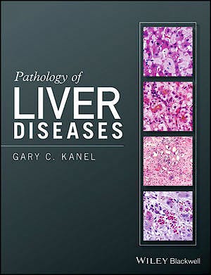 Portada del libro 9781118895030 Pathology of Liver Diseases