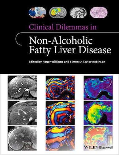 Portada del libro 9781118912034 Clinical Dilemmas in Non-Alcoholic Fatty Liver Disease
