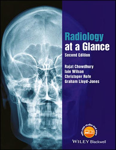 Portada del libro 9781118914779 Radiology at a Glance