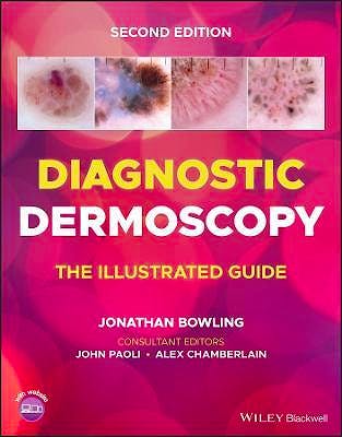 Diagnostic Dermoscopy. The Illustrated Guide