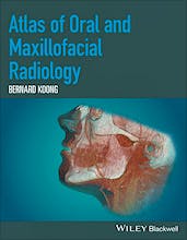 Portada del libro 9781118939642 Atlas of Oral and Maxillofacial Radiology