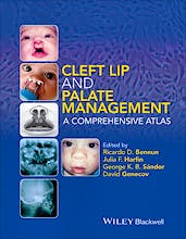 Cleft Lip and Palate Management: A Comprehensive Atlas