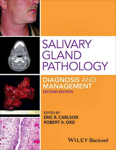Salivary Gland Pathology. Diagnosis and Management