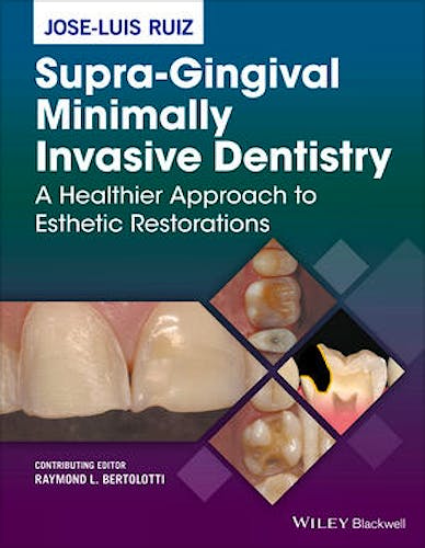 Portada del libro 9781118976418 Supra-Gingival Minimally Invasive Dentistry: A Healthier Approach to Esthetic Restorations