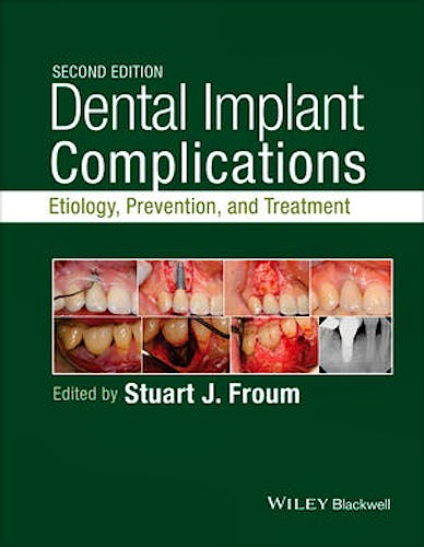Portada del libro 9781118976456 Dental Implant Complications. Etiology, Prevention, and Treatment
