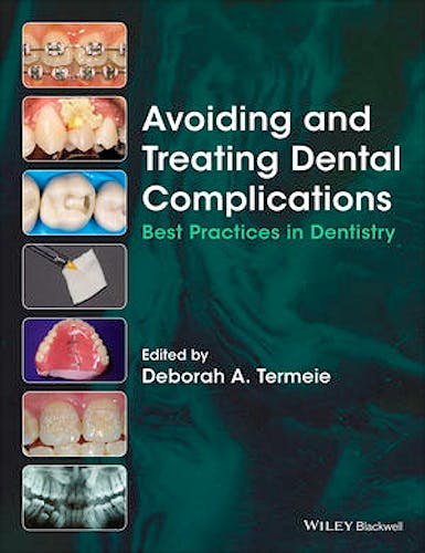 Portada del libro 9781118988022 Avoiding and Treating Dental Complications: Best Practices in Dentistry
