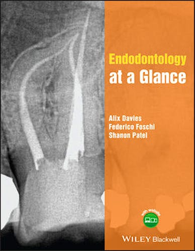 Portada del libro 9781118994702 Endodontology at a Glance