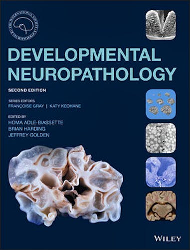 Portada del libro 9781119013082 Developmental Neuropathology