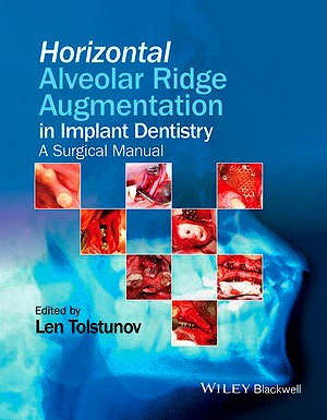 Portada del libro 9781119019886 Horizontal Alveolar Ridge Augmentation in Implant Dentistry. a Surgical Manual