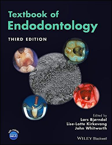 Portada del libro 9781119057314 Textbook of Endodontology
