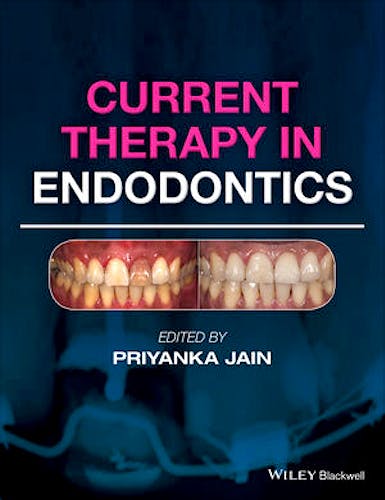 Portada del libro 9781119067559 Current Therapy in Endodontics