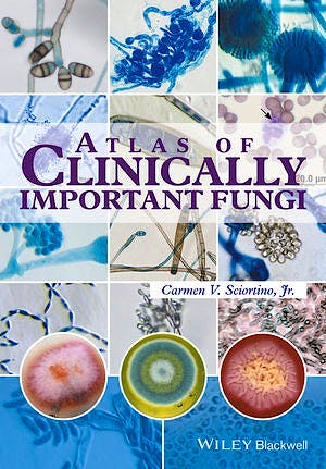 Portada del libro 9781119069669 Atlas of Clinically Important Fungi
