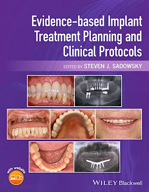 Portada del libro 9781119080039 Evidence-Based Implant Treatment Planning and Clinical Protocols