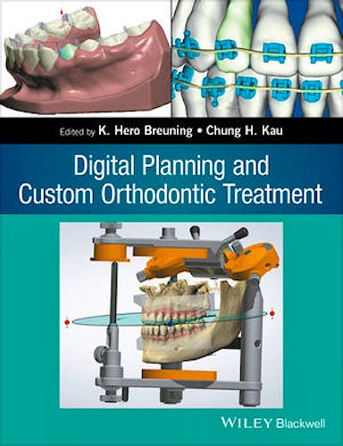 Portada del libro 9781119087779 Digital Planning and Custom Orthodontic Treatment