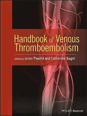 Portada del libro 9781119095576 Handbook of Venous Thromboembolism