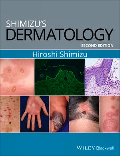 Portada del libro 9781119099055 Shimizu's Dermatology