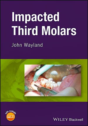 Portada del libro 9781119118336 Impacted Third Molars