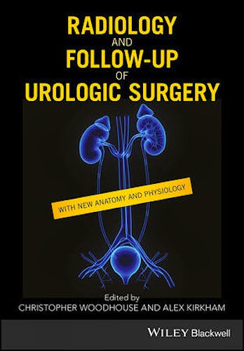 Portada del libro 9781119162087 Radiology and Follow-Up of Urologic Surgery
