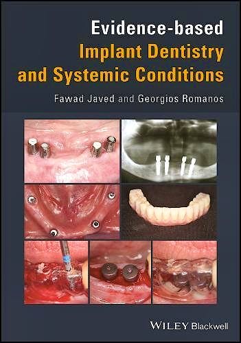 Portada del libro 9781119212249 Evidence-Based Implant Dentistry and Systemic Conditions