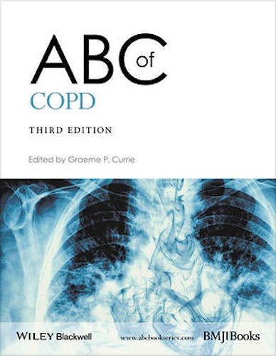 Portada del libro 9781119212850 Abc of COPD