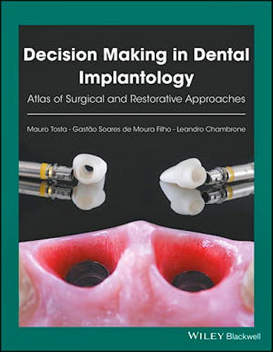 Portada del libro 9781119225942 Decision Making in Dental Implantology. Atlas of Surgical and Restorative Approaches